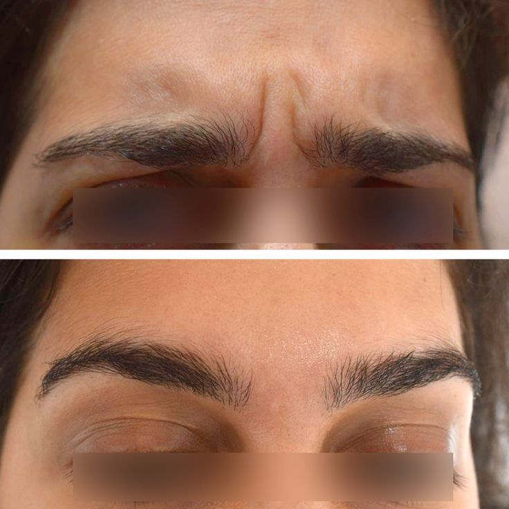 buy restyaane eyelight online buy restyaane eyelight online buy restyaane eyelight online buy restyaane eyelight online buy restyaane eyelight online buy restyaane eyelight online buy restyaane eyelight online buy restyaane eyelight online buy restyaane eyelight online buy restyaane eyelight online buy restyaane eyelight online buy restyaane eyelight online buy restyaane eyelight online buy restyaane eyelight online buy restyaane eyelight online buy restyaane eyelight online buy restyaane eyelight online buy restyaane eyelight online buy restyaane eyelight online buy restyaane eyelight online buy restyaane eyelight online buy restyaane eyelight online buy restyaane eyelight online buy restyaane eyelight online buy restyaane eyelight online buy restyaane eyelight online buy restyaane eyelight online buy restyaane eyelight online buy restyaane eyelight online buy restyaane eyelight online buy restyaane eyelight online buy restyaane eyelight online buy restyaane eyelight online buy restyaane eyelight online buy restyaane eyelight online buy restyaane eyelight online buy restyaane eyelight online buy restyaane eyelight online buy restyaane eyelight online buy restyaane eyelight online buy restyaane eyelight online buy restyaane eyelight online buy restyaane eyelight online buy restyaane eyelight online buy restyaane eyelight online buy restyaane eyelight online buy restyaane eyelight online buy restyaane eyelight online buy restyaane eyelight online buy restyaane eyelight online buy restyaane eyelight online buy restyaane eyelight online buy restyaane eyelight online buy restyaane eyelight online buy restyaane eyelight online buy restyaane eyelight online buy restyaane eyelight online buy restyaane eyelight online buy restyaane eyelight online buy restyaane eyelight online buy restyaane eyelight online buy restyaane eyelight online buy restyaane eyelight online buy restyaane eyelight online buy restyaane eyelight online buy restyaane eyelight online buy restyaane eyelight online buy restyaane eyelight online buy restyaane eyelight online buy restyaane eyelight online buy restyaane eyelight online buy restyaane eyelight online buy restyaane eyelight online buy restyaane eyelight online buy restyaane eyelight online buy restyaane eyelight online buy restyaane eyelight online buy restyaane eyelight online buy restyaane eyelight online buy restyaane eyelight online buy restyaane eyelight online buy restyaane eyelight online buy restyaane eyelight online buy restyaane eyelight online buy restyaane eyelight online buy restyaane eyelight online buy restyaane eyelight online buy restyaane eyelight online buy restyaane eyelight online buy restyaane eyelight online buy restyaane eyelight online buy restyaane eyelight online buy restyaane eyelight online buy restyaane eyelight online buy restyaane eyelight online buy restyaane eyelight online buy restyaane eyelight online buy restyaane eyelight online buy restyaane eyelight online buy restyaane eyelight online buy restyaane eyelight online buy restyaane eyelight online buy restyaane eyelight online buy restyaane eyelight online buy restyaane eyelight online buy restyaane eyelight online buy restyaane eyelight online buy restyaane eyelight online buy restyaane eyelight online buy restyaane eyelight online buy restyaane eyelight online buy restyaane eyelight online buy restyaane eyelight online buy restyaane eyelight online buy restyaane eyelight online buy restyaane eyelight online buy restyaane eyelight online buy restyaane eyelight online buy restyaane eyelight online buy restyaane eyelight online buy restyaane eyelight online buy restyaane eyelight online buy restyaane eyelight online buy restyaane eyelight online buy restyaane eyelight online buy restyaane eyelight online buy restyaane eyelight online buy restyaane eyelight online buy restyaane eyelight online buy restyaane eyelight online buy restyaane eyelight online buy restyaane eyelight online buy restyaane eyelight online buy restyaane eyelight online buy restyaane eyelight online buy restyaane eyelight online buy restyaane eyelight online buy restyaane eyelight online buy restyaane eyelight online buy restyaane eyelight online buy restyaane eyelight online buy restyaane eyelight online buy restyaane eyelight online buy restyaane eyelight online buy restyaane eyelight online buy restyaane eyelight online buy restyaane eyelight online buy restyaane eyelight online buy restyaane eyelight online buy restyaane eyelight online buy restyaane eyelight online buy restyaane eyelight online buy restyaane eyelight online buy restyaane eyelight online buy restyaane eyelight online buy restyaane eyelight online buy restyaane eyelight online buy restyaane eyelight online buy restyaane eyelight online buy restyaane eyelight online buy restyaane eyelight online buy restyaane eyelight online buy restyaane eyelight online buy restyaane eyelight online buy restyaane eyelight online buy restyaane eyelight online buy restyaane eyelight online buy restyaane eyelight online buy restyaane eyelight online buy restyaane eyelight online buy restyaane eyelight online buy restyaane eyelight online buy restyaane eyelight online buy restyaane eyelight online