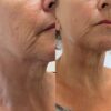 buy juvederm voluma xc online buy juvederm voluma xc onlinebuy juvederm voluma xc onlinebuy juvederm voluma xc onlinebuy juvederm voluma xc onlinebuy juvederm voluma xc onlinebuy juvederm voluma xc onlinebuy juvederm voluma xc onlinebuy juvederm voluma xc onlinebuy juvederm voluma xc onlinebuy juvederm voluma xc onlinebuy juvederm voluma xc onlinebuy juvederm voluma xc onlinebuy juvederm voluma xc onlinebuy juvederm voluma xc onlinebuy juvederm voluma xc onlinebuy juvederm voluma xc onlinebuy juvederm voluma xc onlinebuy juvederm voluma xc onlinebuy juvederm voluma xc onlinebuy juvederm voluma xc onlinebuy juvederm voluma xc onlinebuy juvederm voluma xc onlinebuy juvederm voluma xc onlinebuy juvederm voluma xc onlinebuy juvederm voluma xc onlinebuy juvederm voluma xc onlinebuy juvederm voluma xc onlinebuy juvederm voluma xc onlinebuy juvederm voluma xc onlinebuy juvederm voluma xc onlinebuy juvederm voluma xc onlinebuy juvederm voluma xc onlinebuy juvederm voluma xc onlinebuy juvederm voluma xc onlinebuy juvederm voluma xc onlinebuy juvederm voluma xc onlinebuy juvederm voluma xc onlinebuy juvederm voluma xc onlinebuy juvederm voluma xc onlinebuy juvederm voluma xc onlinebuy juvederm voluma xc onlinebuy juvederm voluma xc onlinebuy juvederm voluma xc onlinebuy juvederm voluma xc onlinebuy juvederm voluma xc onlinebuy juvederm voluma xc onlinebuy juvederm voluma xc onlinebuy juvederm voluma xc onlinebuy juvederm voluma xc onlinebuy juvederm voluma xc onlinebuy juvederm voluma xc onlinebuy juvederm voluma xc onlinebuy juvederm voluma xc onlinebuy juvederm voluma xc onlinebuy juvederm voluma xc onlinebuy juvederm voluma xc onlinebuy juvederm voluma xc onlinebuy juvederm voluma xc onlinebuy juvederm voluma xc onlinebuy juvederm voluma xc onlinebuy juvederm voluma xc onlinebuy juvederm voluma xc onlinebuy juvederm voluma xc onlinebuy juvederm voluma xc onlinebuy juvederm voluma xc onlinebuy juvederm voluma xc online Juvederm Voluma filler Juvederm cheek filler chin and midface enhancement filler Juvederm Voluma with lidocaine FDA-approved dermal filler purchase Juvederm Voluma non-surgical cheek augmentation long-lasting hyaluronic fille