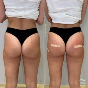 buy sculptra butt lift online buy sculptra butt lift online buy sculptra butt lift online buy sculptra butt lift online buy sculptra butt lift online buy sculptra butt lift online buy sculptra butt lift online buy sculptra butt lift online buy sculptra butt lift online buy sculptra butt lift online buy sculptra butt lift online buy sculptra butt lift online buy sculptra butt lift online buy sculptra butt lift online buy sculptra butt lift online buy sculptra butt lift online buy sculptra butt lift online buy sculptra butt lift online buy sculptra butt lift online buy sculptra butt lift online buy sculptra butt lift online buy sculptra butt lift online buy sculptra butt lift online buy sculptra butt lift online buy sculptra butt lift online buy sculptra butt lift online buy sculptra butt lift online buy sculptra butt lift online buy sculptra butt lift online buy sculptra butt lift online buy sculptra butt lift online buy sculptra butt lift online buy sculptra butt lift online buy sculptra butt lift online buy sculptra butt lift online buy sculptra butt lift online buy sculptra butt lift online buy sculptra butt lift online buy sculptra butt lift online buy sculptra butt lift online buy sculptra butt lift online buy sculptra butt lift online buy sculptra butt lift online buy sculptra butt lift online buy sculptra butt lift online buy sculptra butt lift online buy sculptra butt lift online buy sculptra butt lift online buy sculptra butt lift online buy sculptra butt lift online buy sculptra butt lift online buy sculptra butt lift online buy sculptra butt lift online buy sculptra butt lift online buy sculptra butt lift online buy sculptra butt lift online buy sculptra butt lift online buy sculptra butt lift online buy sculptra butt lift online buy sculptra butt lift online buy sculptra butt lift online buy sculptra butt lift online buy sculptra butt lift online buy sculptra butt lift online buy sculptra butt lift online buy sculptra butt lift online buy sculptra butt lift online buy sculptra butt lift online buy sculptra butt lift online buy sculptra butt lift online buy sculptra butt lift online buy sculptra butt lift online buy sculptra butt lift online buy sculptra butt lift online buy sculptra butt lift online buy sculptra butt lift online buy sculptra butt lift online buy sculptra butt lift online buy sculptra butt lift online buy sculptra butt lift online buy sculptra butt lift online buy sculptra butt lift online buy sculptra butt lift online buy sculptra butt lift online buy sculptra butt lift online buy sculptra butt lift online buy sculptra butt lift online buy sculptra butt lift online buy sculptra butt lift online buy sculptra butt lift online buy sculptra butt lift online buy sculptra butt lift online buy sculptra butt lift online buy sculptra butt lift online buy sculptra butt lift online buy sculptra butt lift online buy sculptra butt lift online buy sculptra butt lift online