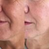 Buy Profhilo online Purchase Profhilo injection Order Profhilo treatment Where to buy Profhilo Profhilo for sale Profhilo online supplier Profhilo wholesale Profhilo injectable buy Shop Profhilo filler Buy Profhilo for clinic Profhilo skin booster buy Injectable moisturizer Bioremodeling treatment Hyaluronic acid skin booster Non-surgical skin rejuvenation Skin booster injection Anti-aging injectable Collagen-stimulating filler Natural skin filler Profhilo before and after Profhilo treatment cost How does Profhilo work Profhilo vs dermal fillers Profhilo neck treatment Profhilo face results Profhilo injection points